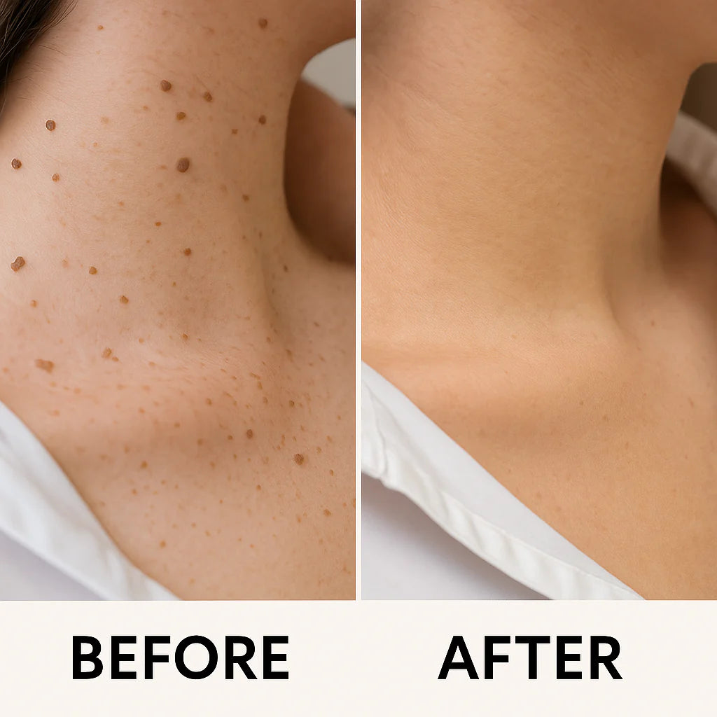 MediSkin Laser